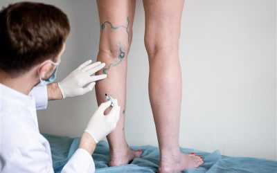 The CORE Institute: Varicose Vein Care in Phoenix During National Vein Month